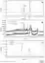 Fig. 06 - Process for polysorbate quantification in a sample involving LC-MS with an internal standard