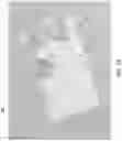 Fig. 02 - Microfluidic tissue biopsy and immune response drug evaluation devices and systems