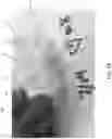 Fig. 03 - Microfluidic tissue biopsy and immune response drug evaluation devices and systems