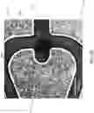 Fig. 05 - Microfluidic tissue biopsy and immune response drug evaluation devices and systems