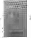 Fig. 07 - Microfluidic tissue biopsy and immune response drug evaluation devices and systems