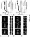 Fig. 16 - METHODS AND ASSAYS FOR MODULATING GENE TRANSCRIPTION BY MODULATING CONDENSATES