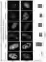 Fig. 47 - METHODS AND ASSAYS FOR MODULATING GENE TRANSCRIPTION BY MODULATING CONDENSATES