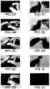Fig. 03 - CHIPS, DETECTORS, AND METHODS OF MAKING AND USING THE SAME