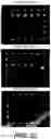 Fig. 24 - CHIPS, DETECTORS, AND METHODS OF MAKING AND USING THE SAME