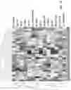 Fig. 02 - Circulating tumor markers for meningiomas