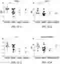 Fig. 05 - Circulating tumor markers for meningiomas