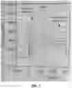Fig. 04 - METHODS FOR DETECTION AND CHARACTERIZATION OF ANTI-VIRAL VECTOR ANTIBODIES