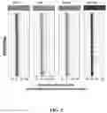 Fig. 04 - Urine metabolomics based method of detecting renal allograft injury