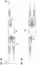 Fig. 27 - Fiber optic adapter and cassette