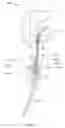 Fig. 04 - Cable termination assembly with disengagement prevention structures