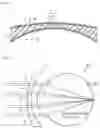 Fig. 05 - Spectacle lens and method for designing the same
