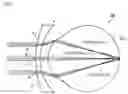 Fig. 06 - Spectacle lens and method for designing the same
