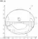Fig. 09 - Bifocal spectacle lens, computer implemented method for creating a numerical representation of same, computer program, data processing system, and non-volatile computer readable storage medium