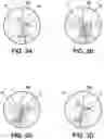 Fig. 04 - METHOD FOR DETERMINING A PROGRESSIVE LENS AND ASSOCIATED SYSTEM