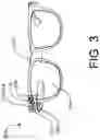 Fig. 05 - Augmented reality assisted physical form completion