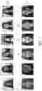 Fig. 08 - Identity obfuscation in images utilizing synthesized faces