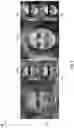 Fig. 08 - NON-LINEAR LATENT FILTER TECHNIQUES FOR IMAGE EDITING