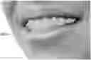 Fig. 01 - Automated braces removal from images