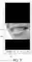 Fig. 04 - Automated braces removal from images