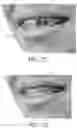 Fig. 09 - Automated braces removal from images