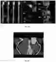 Fig. 31 - Systems, methods, and devices for medical image analysis, diagnosis, risk stratification, decision making and/or disease tracking
