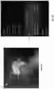 Fig. 38 - Systems, methods, and devices for medical image analysis, diagnosis, risk stratification, decision making and/or disease tracking