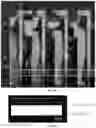 Fig. 42 - Systems, methods, and devices for medical image analysis, diagnosis, risk stratification, decision making and/or disease tracking
