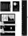 Fig. 54 - Systems, methods, and devices for medical image analysis, diagnosis, risk stratification, decision making and/or disease tracking