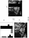 Fig. 08 - Techniques for determining tissue characteristics using multiplexed immunofluorescence imaging