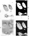 Fig. 31 - Techniques for determining tissue characteristics using multiplexed immunofluorescence imaging
