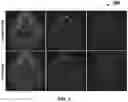 Fig. 09 - Probabilistic segmentation of volumetric images
