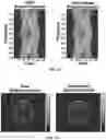 Fig. 11 - Calibration method for a spectral computerized tomography system