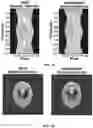Fig. 12 - Calibration method for a spectral computerized tomography system