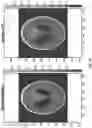 Fig. 13 - Calibration method for a spectral computerized tomography system