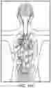 Fig. 33 - Augmented reality system for displaying patient data