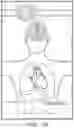 Fig. 34 - Augmented reality system for displaying patient data