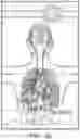 Fig. 35 - Augmented reality system for displaying patient data