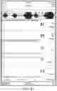 Fig. 55 - Augmented reality system for displaying patient data