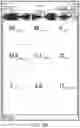 Fig. 78 - Augmented reality system for displaying patient data