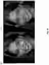 Fig. 12 - IDENTITY-PRESERVING TECHNIQUES FOR GENERATIVE ADVERSARIAL NETWORK  PROJECTION
