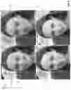 Fig. 06 - Detail-preserving image editing techniques