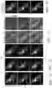 Fig. 10 - Volumetric microscopy methods and systems using recurrent neural networks