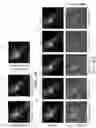 Fig. 12 - Volumetric microscopy methods and systems using recurrent neural networks