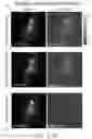 Fig. 22 - Volumetric microscopy methods and systems using recurrent neural networks