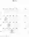 Fig. 10 - Learning image generation device, learning image generation method, learning image generation program, learning method, learning device, and learning program
