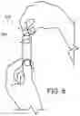 Fig. 09 - Apparatus and Method for Recognition of Medication Administration Indicator