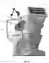 Fig. 03 - Using artificial intelligence and biometric data for serial screening exams for medical conditions