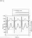Fig. 06 - Plasma processing apparatus and plasma processing method