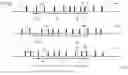 Fig. 04 - Determining the average frequency of a series of pulses